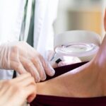 Los mejores dermatólogos de Madrid